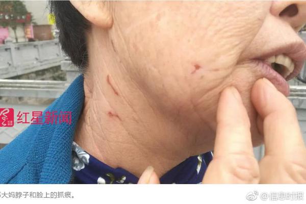 电饭锅预约2小时是2小时后开始煮吗